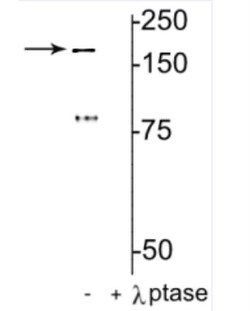 NMDAR2B, p Tyr1472 Antibody, Novus Biologicals 0.1mL; Unlabeled:Antibodies,
